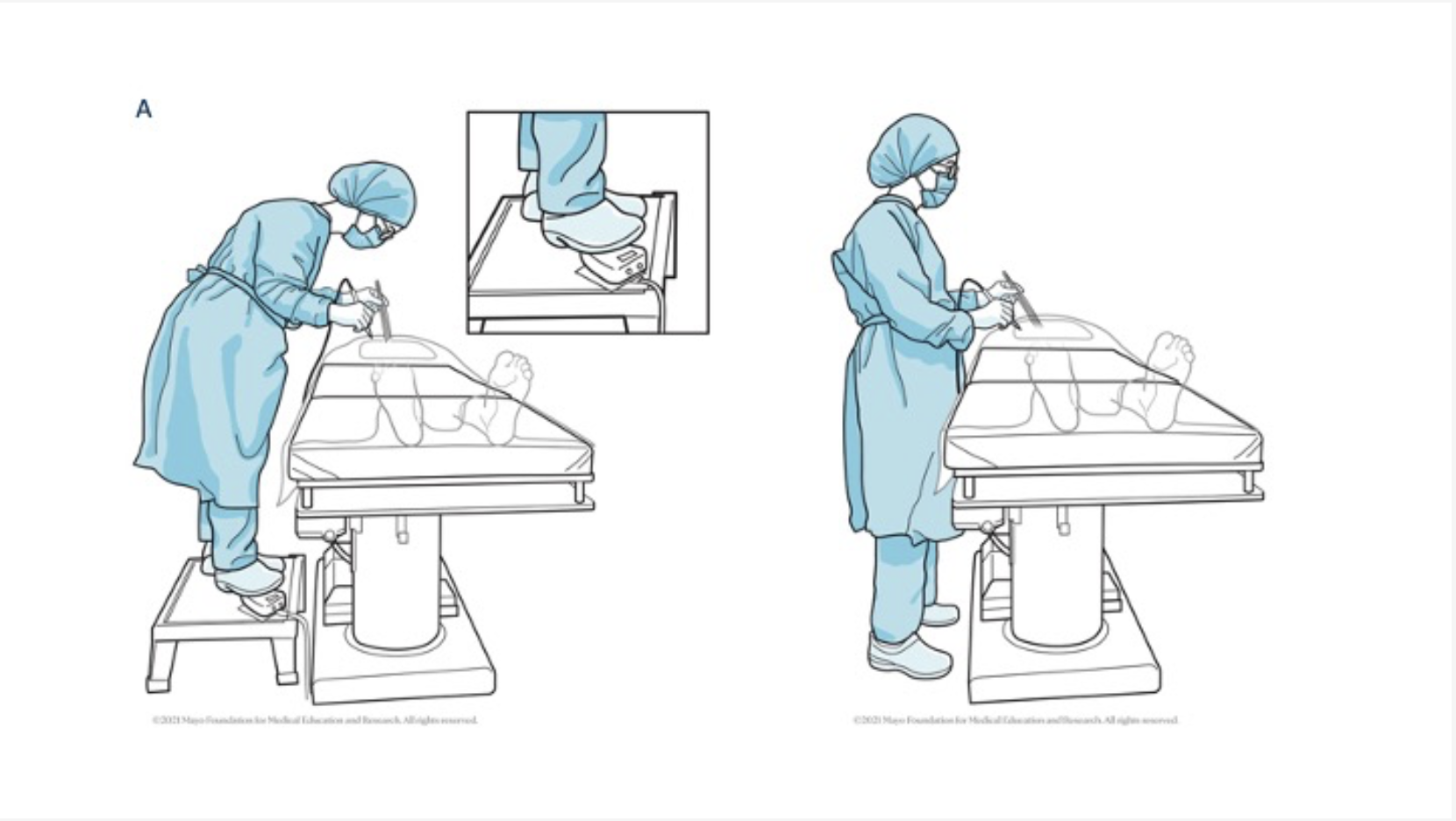 Operating-table height and surgeon posture. Reproduced from Surgical Ergonomics: How and Where to Start? - Hallet, Alam and Halbeck, BJS 2024. https://doi.org/10.58974/bjss/azbc030